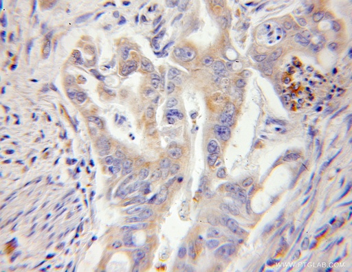 [11271-1-AP-20UL] RPL13 Polyclonal antibody