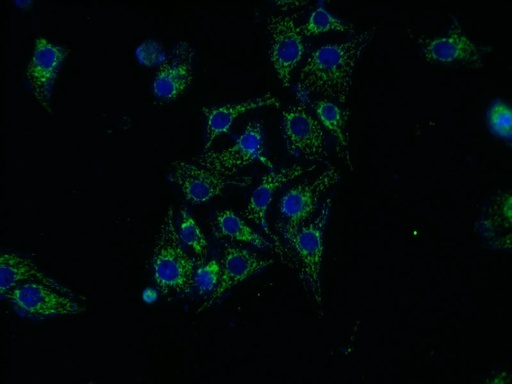 [11274-1-AP-20UL] ASAH1 Polyclonal antibody