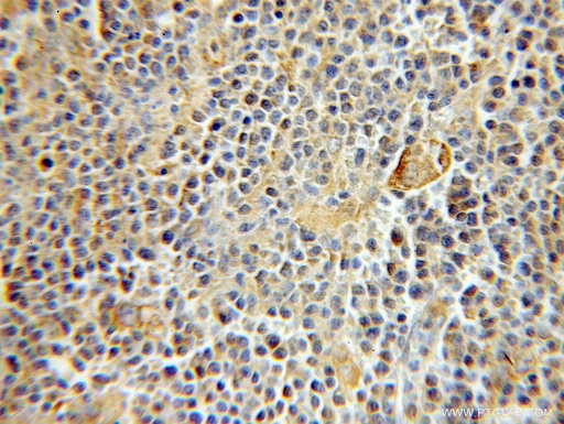 [11277-1-AP-20UL] RMP Polyclonal antibody