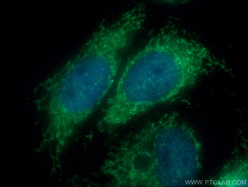 [11278-1-AP-20UL] Tom22 Polyclonal antibody