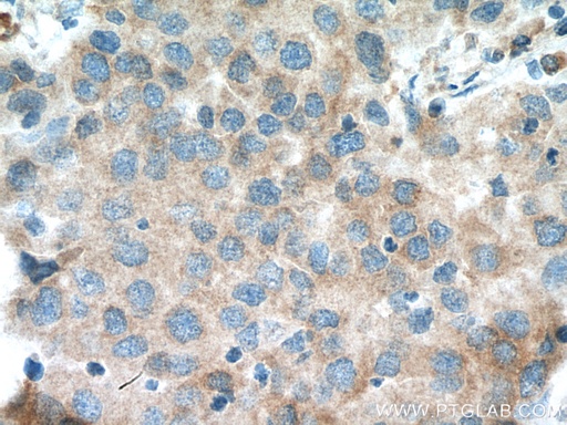 [11280-1-AP-20UL] EIF4A2 Polyclonal antibody