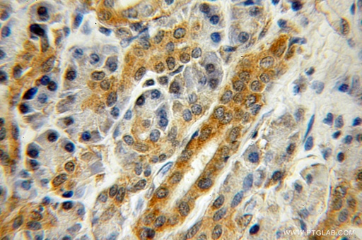 [11282-1-AP-20UL] ZNF2 Polyclonal antibody