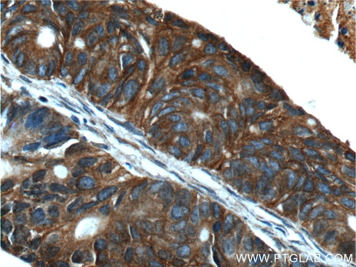 [11283-1-AP-150UL] TMPRSS4 Polyclonal antibody