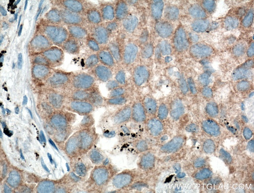 [11285-1-AP-20UL] RNF156 Polyclonal antibody
