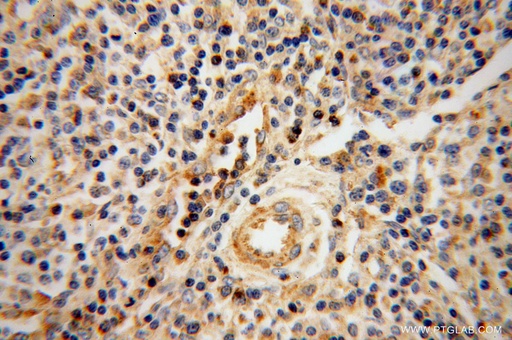 [11288-1-AP-20UL] Granzyme A Polyclonal antibody