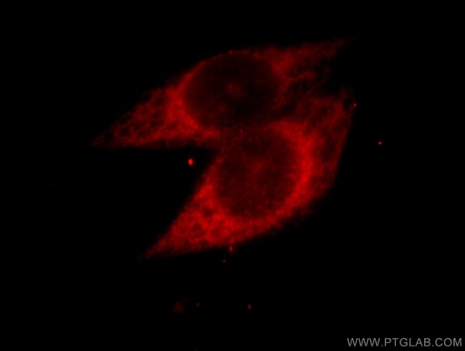 [11289-1-AP-150UL] PARP3 Polyclonal antibody