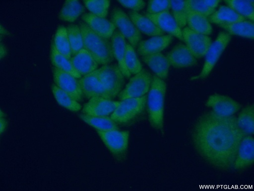 [11290-2-AP-20UL] RPLP0 Polyclonal antibody