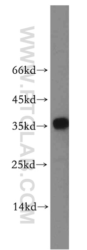 [11292-1-AP-150UL] PLEKHA3 Polyclonal antibody