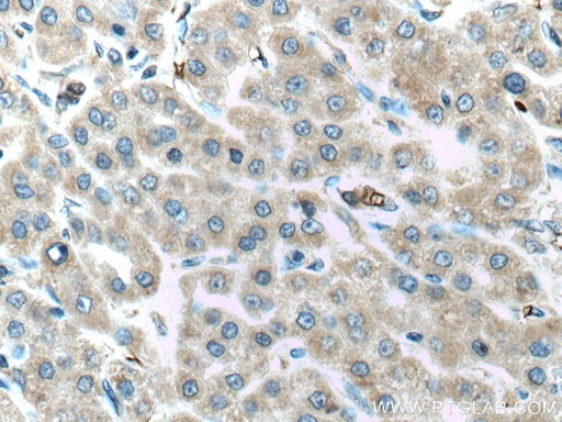 [11293-1-AP-20UL] ALR Polyclonal antibody