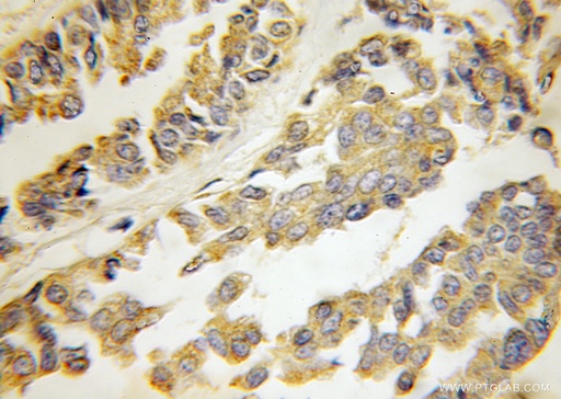 [11301-1-AP-20UL] HARS2 Polyclonal antibody