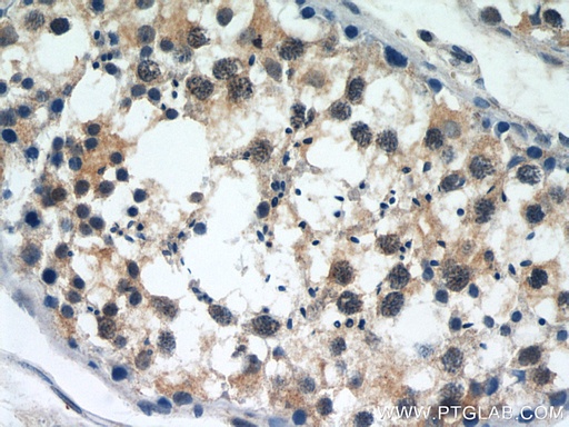 [11303-1-AP-150UL] SERPINE2 Polyclonal antibody