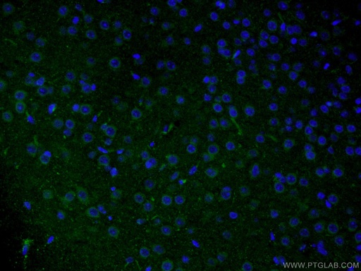 [11304-1-AP-150UL] Rab18 Polyclonal antibody