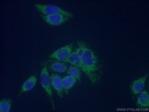 [11305-1-AP-20UL] ECHS1 Polyclonal antibody