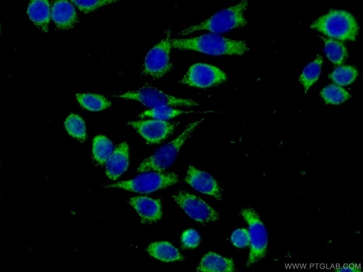 [11307-1-AP-150UL] LPXN Polyclonal antibody