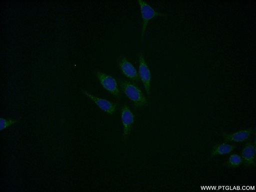 [11309-1-AP-20UL] EIF5A Polyclonal antibody