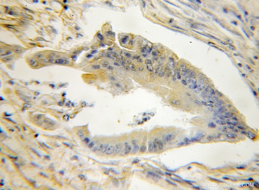 [11311-1-AP-150UL] STMN3 Polyclonal antibody