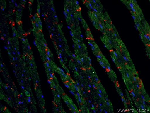 [11313-2-AP-150UL] Alpha Actinin Polyclonal antibody