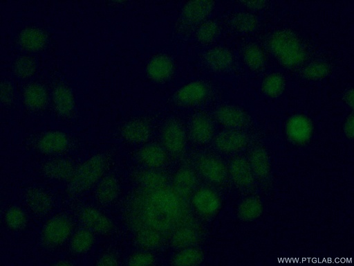[11314-1-AP-150UL] EYA2 Polyclonal antibody