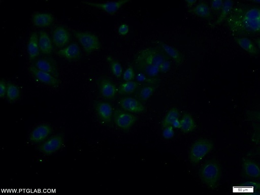 [11315-1-AP-20UL] TOLLIP Polyclonal antibody