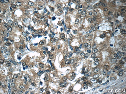 [11316-1-AP-150UL] Aminoacylase 1 Polyclonal antibody