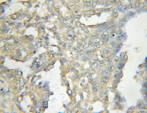 [11318-1-AP-150UL] OSBPL11 Polyclonal antibody