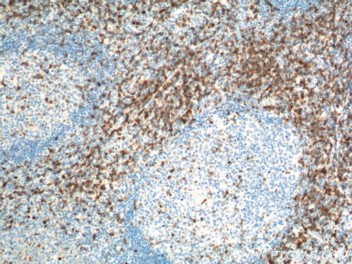 [11320-1-AP-20UL] CD7 Polyclonal antibody