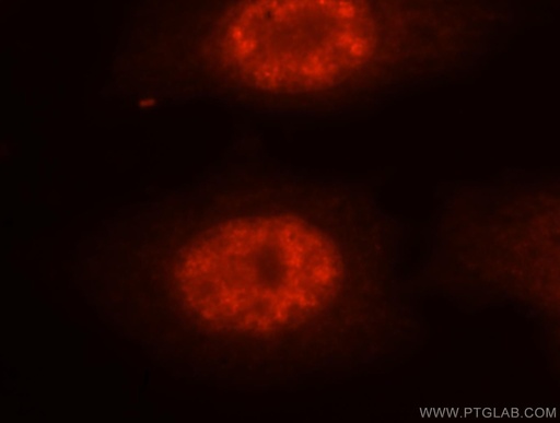 [11323-1-AP-20UL] NASP Polyclonal antibody