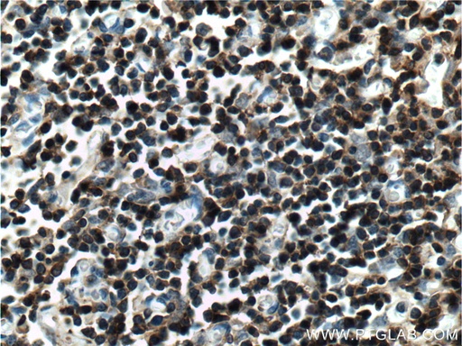 [11326-1-AP-150UL] LAT Polyclonal antibody
