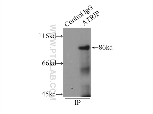 [11327-1-AP-20UL] ATRIP Polyclonal antibody