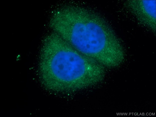 [11329-2-AP-20UL] RAB35 Polyclonal antibody