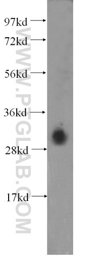 [11330-1-AP-150UL] DNASE1L3 Polyclonal antibody