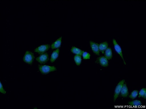 [11331-1-AP-20UL] XPG Polyclonal antibody