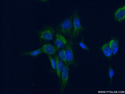 [11332-1-AP-150UL] EIF2B4 Polyclonal antibody