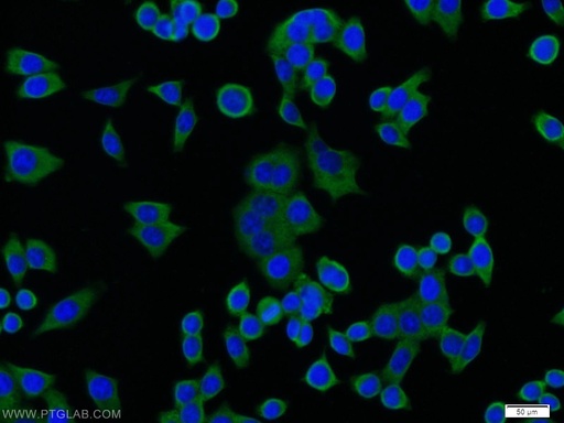 [11334-1-AP-150UL] PTP1B Polyclonal antibody