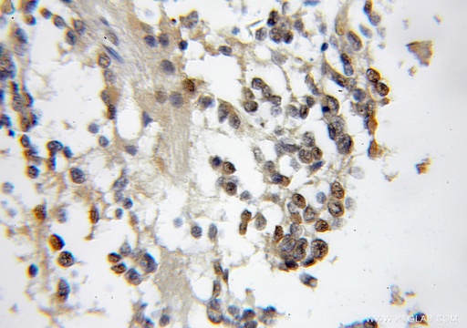 [11336-1-AP-150UL] CBFA2T2 Polyclonal antibody