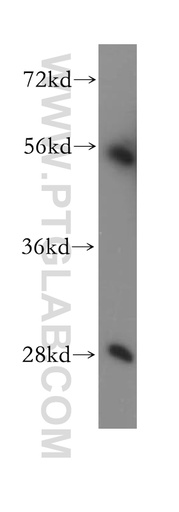 [11338-1-AP-20UL] SUV39H2 Polyclonal antibody