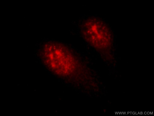 [11339-1-AP-20UL] HOP2 Polyclonal antibody