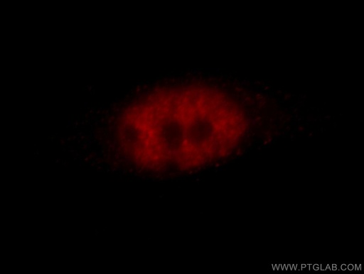 [11341-1-AP-150UL] ZBTB7B Polyclonal antibody
