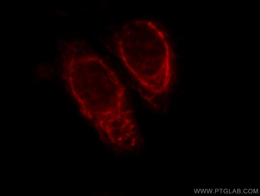 [11342-1-AP-20UL] KRT81 Polyclonal antibody