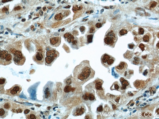 [11344-1-AP-20UL] HDGF Polyclonal antibody