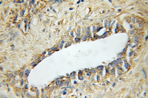 [11346-1-AP-150UL] STAMBP Polyclonal antibody