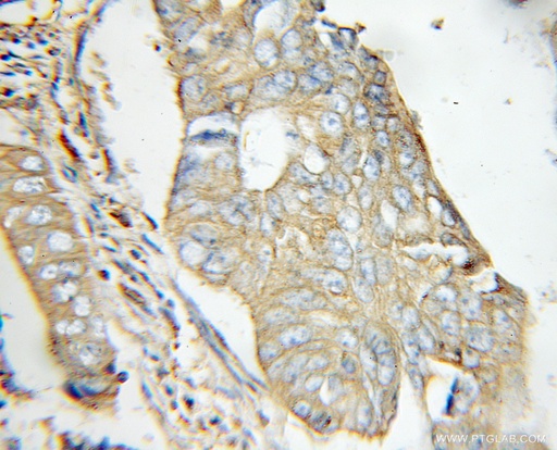 [11348-1-AP-20UL] EXT2 Polyclonal antibody