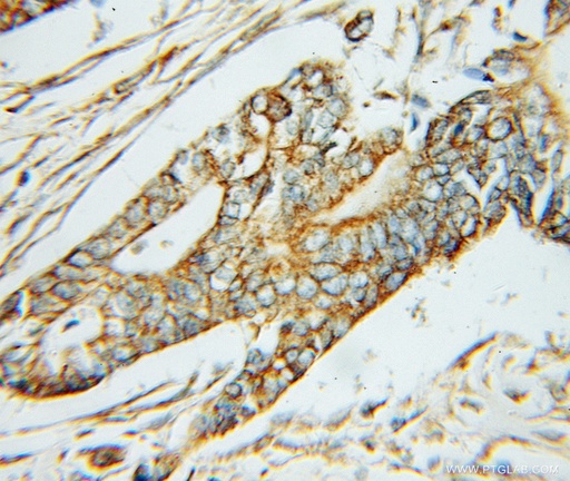 [11349-1-AP-20UL] ABAT Polyclonal antibody