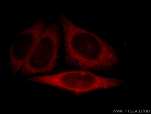 [11353-1-AP-20UL] MYDGF Polyclonal antibody