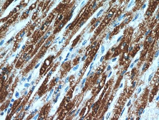 [11354-1-AP-150UL] ART5 Polyclonal antibody