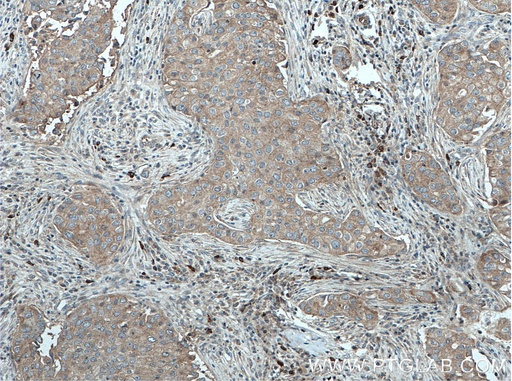 [11355-1-AP-150UL] LGP2 Polyclonal antibody