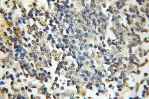 [11357-1-AP-150UL] DDX1 Polyclonal antibody
