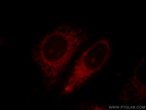 [11358-1-AP-20UL] Harmonin Polyclonal antibody