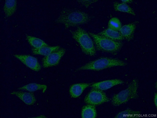 [11360-1-AP-150UL] UMP/CMP kinase Polyclonal antibody