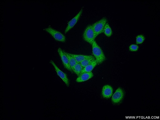 [11363-1-AP-150UL] ARHGEF1 Polyclonal antibody